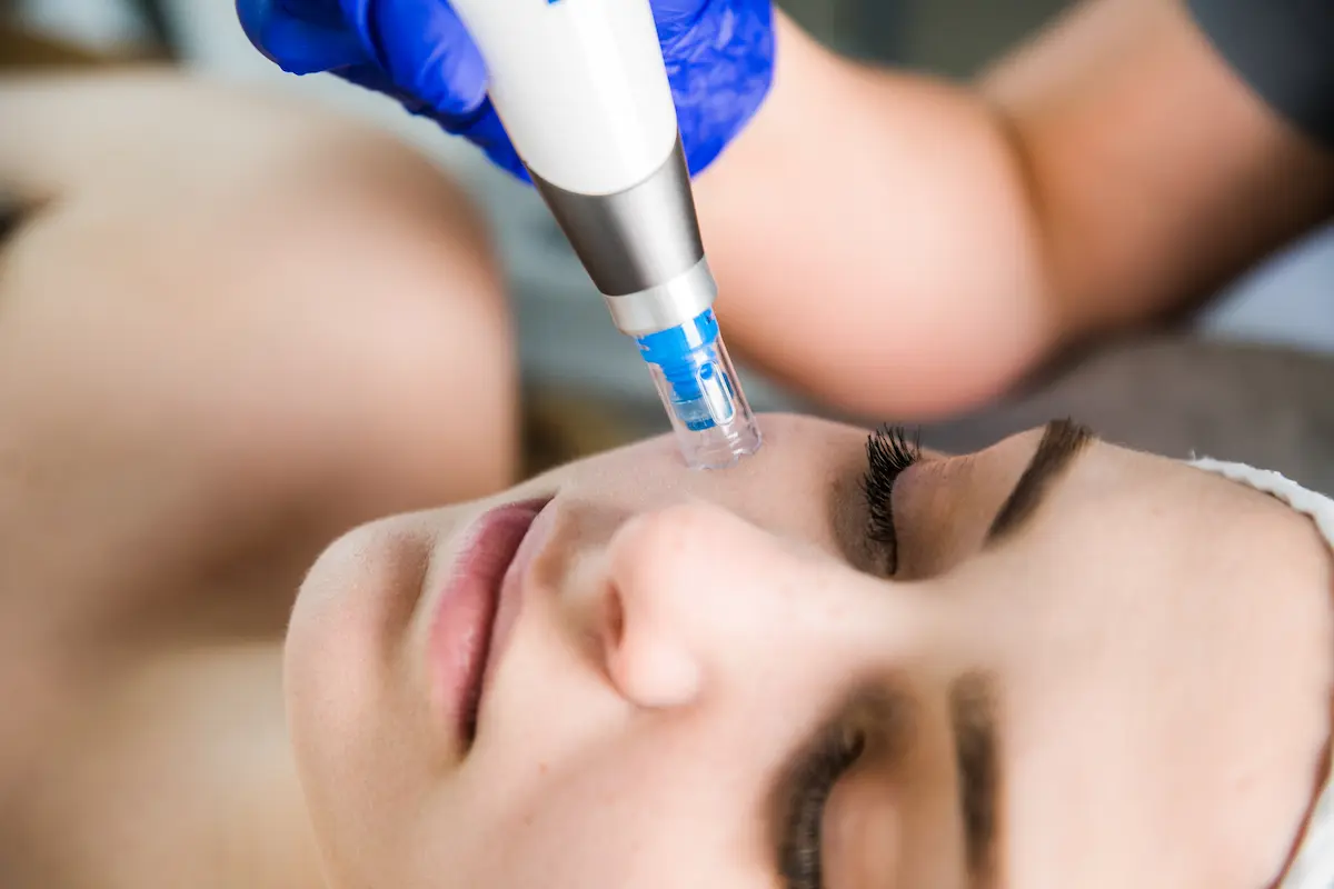 Dermapen – intensywne odmładzanie i regeneracja skóry