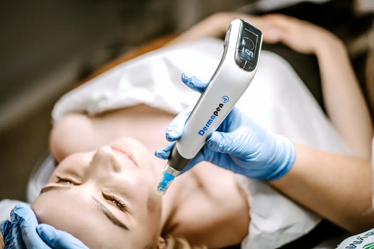 Dermapen – intensywne odmładzanie i regeneracja skóry